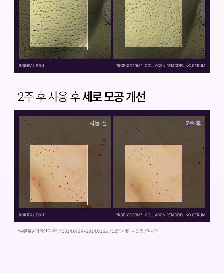 [모공고민] 바이오힐보 프로바이오덤 콜라겐 리모델링 세럼 30ml 더블기획 상세페이지 25
